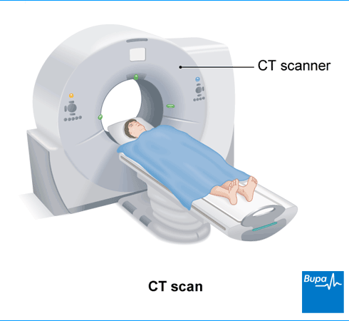 Computed Tomography (CT)