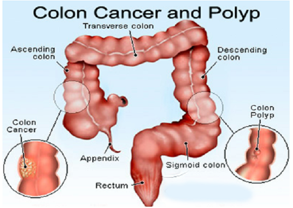 Colon and rectum