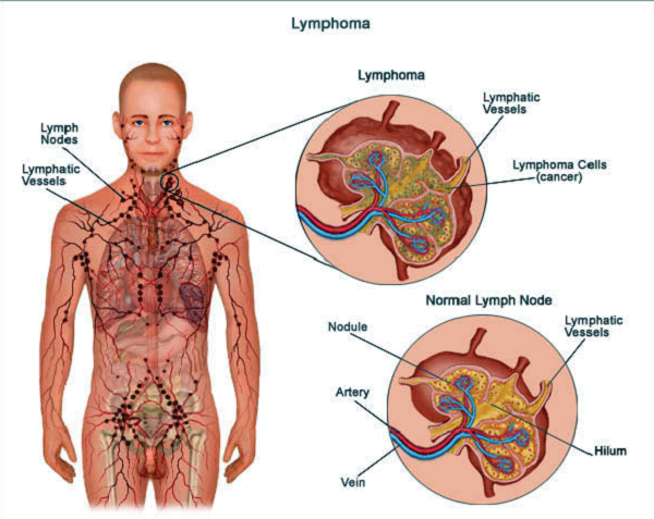 Lymphatic