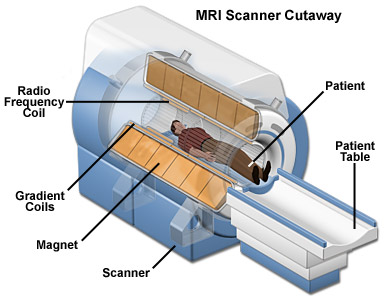 Magnetic Resonance Imaging (MRI)