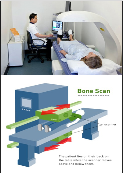 Nuclear Medicine Imaging