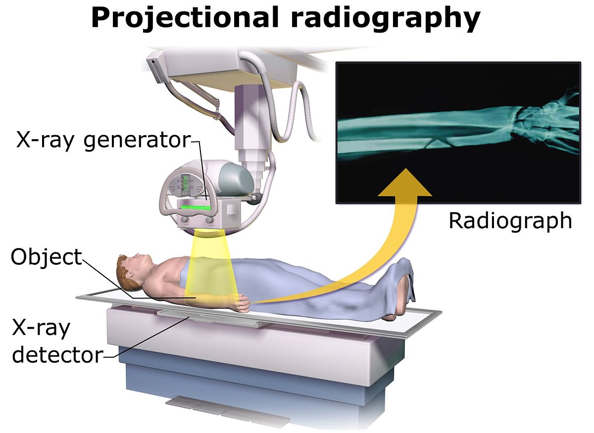 X-rays