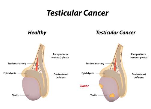 Testis