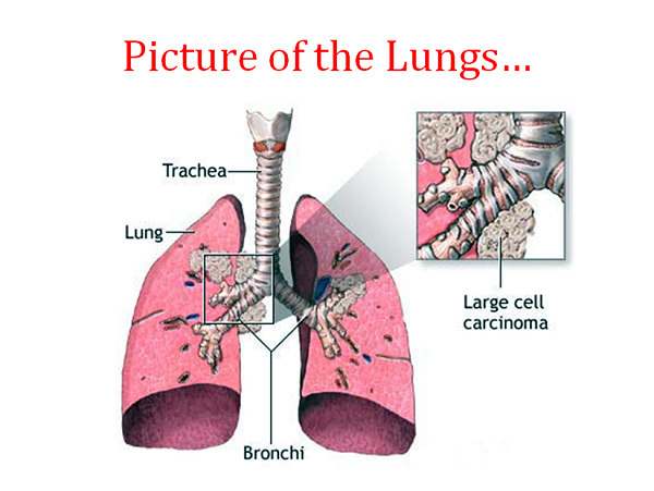 Lung